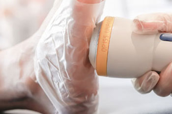 softwave therapy