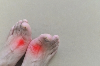 Causes and Symptoms of Gout